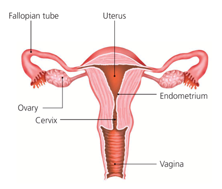 Signs of cervical cancer may include abnormal vaginal bleeding, such as  bleeding between periods, after sex, or after menopause. Addition